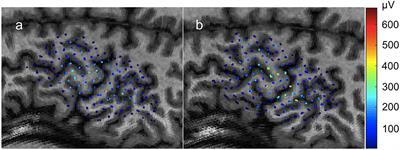 NeuroMeasure: A Software Package for Quantification of Cortical Motor Maps Using Frameless Stereotaxic Transcranial Magnetic Stimulation